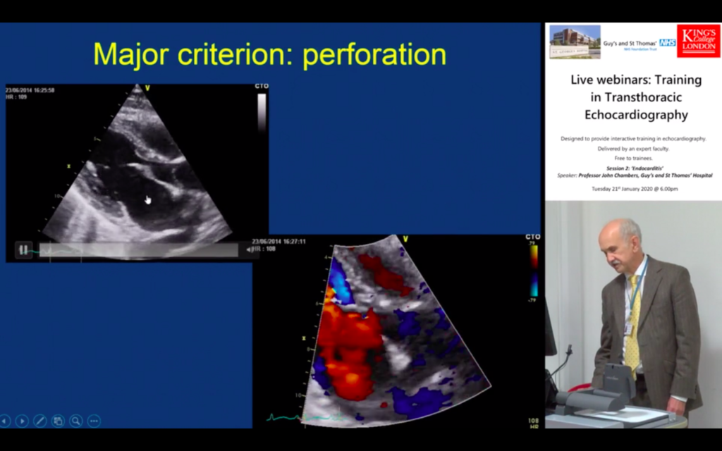 The value of Echocardiography in Endocarditis by Professor John Chambers, Guy’s and St Thomas’ Hospital