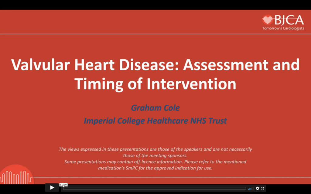 Valvular Heart Disease: Assessment and Timing of intervention